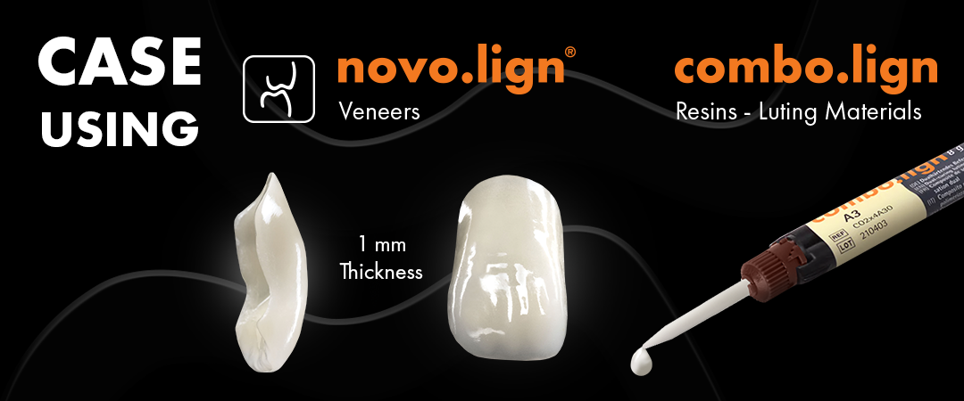 Novo.Lign Veneers & Combo.Lign Resins - Luting Materials Case