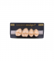 NEO LIGN P TOOTH POST 1G3 UPPER A3.5 4 pc ASST 14, 15, 16, 17