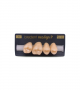 NEO LIGN P TOOTH POST 1G3 UPPER A4 4 pc ASST 14, 15, 16, 17