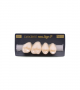 NEO LIGN P TOOTH POST 1G3 UPPER B1 4 pc ASST 14, 15, 16, 17