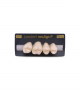 NEO LIGN P TOOTH POST 1G3 UPPER C1 4 pc ASST 14, 15, 16, 17
