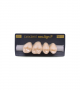 NEO LIGN P TOOTH POST 1G3 UPPER C2 4 pc