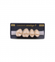 NEO LIGN P TOOTH POST 1G3 UPPER C3 4 pc ASST 14, 15, 16, 17