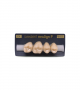 NEO LIGN P TOOTH POST 1G3 UPPER C4 4 pc ASST 14, 15, 16, 17