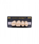 NEO LIGN P TOOTH POST 1G3 UPPER D2 4 pc