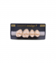 NEO LIGN P TOOTH POST 1G3 UPPER D3 4 pc ASST 14, 15, 16, 17