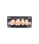 NEO LIGN P TOOTH POST 1G4 UPPER A2 4 pc ASST 14, 15, 16, 17