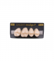 NEO LIGN P TOOTH POST 1G4 UPPER C1 4 pc ASST 14, 15, 16, 17