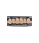 NEO LIGN A TOOTH ANT D48 UPPER C3 6 pc ASST 13, 12, 11, 21, 22, 23