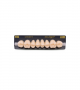 NEO LIGN P TOOTH POST WL4 UPPER A2 8 pc ASST 14, 15, 16, 17/24, 25, 26, 27