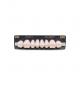 NEO LIGN P TOOTH POST WL4 UPPER BL3 8 pc