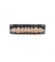 NEO LIGN P TOOTH POST WL4 UPPER C3 8 pc ASST 14, 15, 16, 17/24, 25, 26, 27