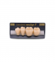 NEO LIGN P TOOTH POST 3G3 LOWER B3 4 pc ASST 34, 35, 36, 37