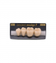 NEO LIGN P TOOTH POST 3G3 LOWER C3 4 pc ASST 34, 35, 36, 37