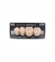 NEO LIGN P TOOTH POST 3G4 LOWER C1 4 pc