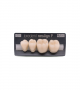 NEO LIGN P TOOTH POST 3G4 LOWER C1 4 pc ASST 34, 35, 36, 37