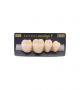NEO LIGN P TOOTH POST 4G4 LOWER B1 4 pc ASST 44, 45, 46, 47