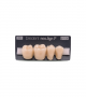 NEO LIGN P TOOTH POST 4G4 LOWER D3 4 pc ASST 44, 45, 46, 47