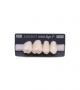 NOVO LIGN P VENEER POST G3 UPPER A1 4 pc ASST 14, 15, 16, 17
