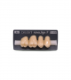 NOVO LIGN P VENEER POST G3 UPPER A4 4 pc ASST 14, 15, 16, 17