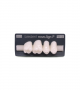 NOVO LIGN P VENEER POST G3 UPPER BL3 4 pc ASST 14, 15, 16, 17