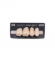 NOVO LIGN P VENEER POST G3 UPPER C1 4 pc