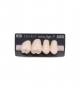 NOVO LIGN P VENEER POST G4 UPPER A1 4 pc ASST 14, 15, 16, 17