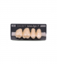 NOVO LIGN P VENEER POST G4 UPPER A3 4 pc ASST 14, 15, 16, 17