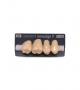 NOVO LIGN P VENEER POST G4 UPPER A4 4 pc ASST 14, 15, 16, 17