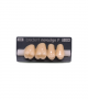 NOVO LIGN P VENEER POST G4 UPPER A4 4 pc