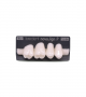 NOVO LIGN P VENEER POST G4 UPPER BL3 4 pc ASST 14, 15, 16, 17
