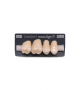 NOVO LIGN P VENEER POST G4 UPPER C2 4 pc ASST 14, 15, 16, 17