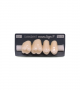 NOVO LIGN P VENEER POST G4 UPPER C2 4 pc