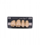 NOVO LIGN P VENEER POST G4 UPPER C4 4 pc ASST 14, 15, 16, 17