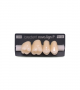 NOVO LIGN P VENEER POST G4 UPPER D2 4 pc ASST 14, 15, 16, 17