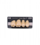 NOVO LIGN P VENEER POST G4 UPPER D4 4 pc