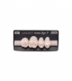 NOVO LIGN P VENEER POST 1W3 UPPER A1 4 pc ASST 14, 15, 16, 17