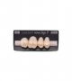 NOVO LIGN P VENEER POST 1W3 UPPER A3 4 pc ASST 14, 15, 16, 17