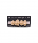 NOVO LIGN P VENEER POST 1W3 UPPER A4 4 pc ASST 14, 15, 16, 17