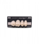 NOVO LIGN P VENEER POST 1W3 UPPER B2 4 pc ASST 14, 15, 16, 17