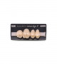 NOVO LIGN P VENEER POST 1W3 UPPER B3 4 pc ASST 14, 15, 16, 17