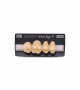 NOVO LIGN P VENEER POST 1W3 UPPER B4 4 pc ASST 14, 15, 16, 17