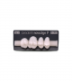 NOVO LIGN P VENEER POST 1W3 UPPER BL3 4 pc ASST 14, 15, 16, 17