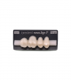 NOVO LIGN P VENEER POST 1W3 UPPER C1 4 pc ASST 14, 15, 16, 17