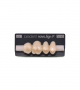 NOVO LIGN P VENEER POST 1W3 UPPER C3 4 pc ASST 14, 15, 16, 17