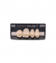 NOVO LIGN P VENEER POST 1W3 UPPER D2 4 pc ASST 14, 15, 16, 17
