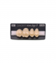 NOVO LIGN P VENEER POST 1W3 UPPER D4 4 pc ASST 14, 15, 16, 17