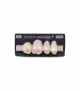 NOVO LIGN P VENEER POST 1W4 UPPER A1 4 pc ASST