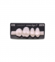 NOVO LIGN P VENEER POST 1W4 UPPER BL3 4 pc ASST