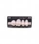 NOVO LIGN P VENEER POST 1W4 UPPER BL3 4 pc ASST 